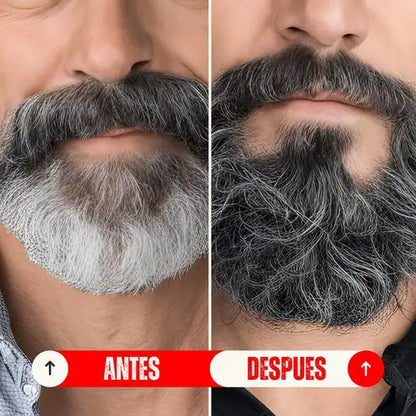 Anti-Gray®️™️¡Dile adiós a las canas de forma natural y sin químicos agresivos!