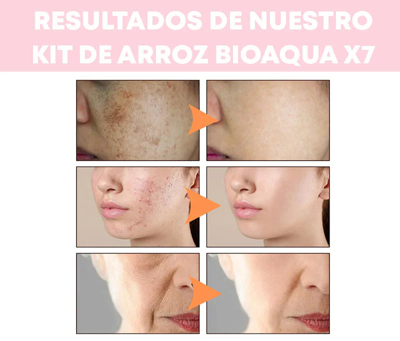 KIT ARROZ DE BIOAQUA - 6 PIEZAS + 1 PROTECTOR SOLAR "PENSAMOS EN TU BELLEZA"